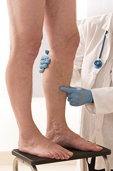 Deep Vein Thrombosis Treatment in Fort Worth, TX